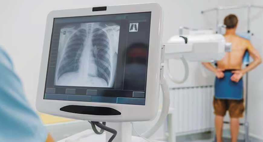 Does Image Compression Hurt Rural Telemedicine? Digital medical imaging